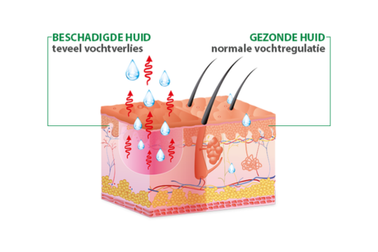 Gezonde en beschadigde huid